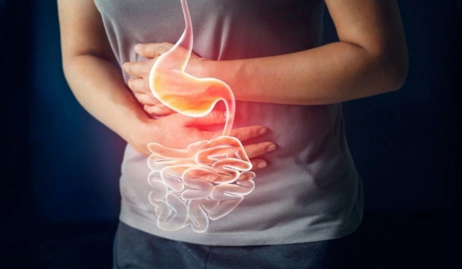 Digestive Health Issues